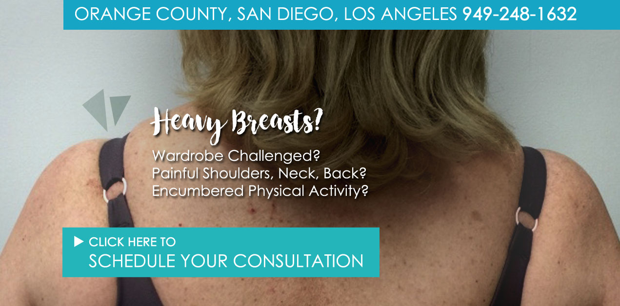 Breast Reduction San Diego & Newport Beach